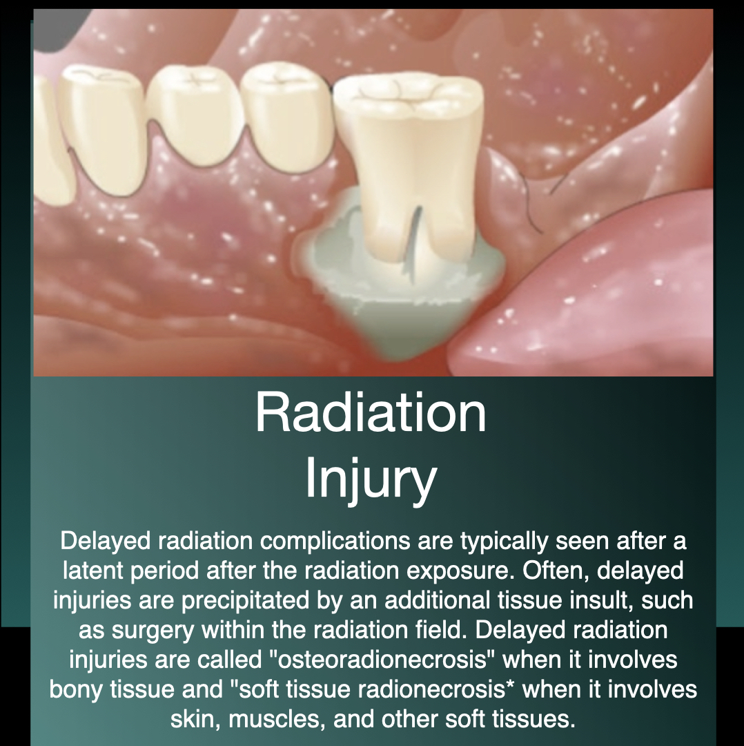 Radiation Injury