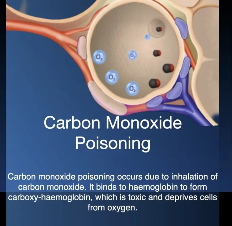 Hyperbaric oxygen therapy for carbon monoxide poisoning