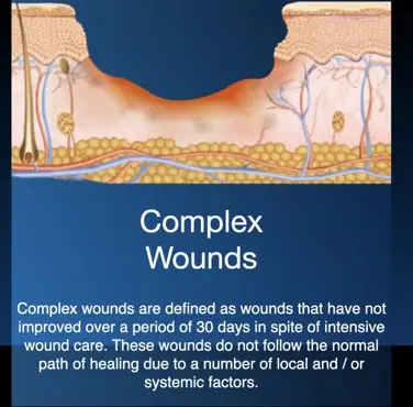 Hiperbariese suurstofterapie for complex non-healing wounds